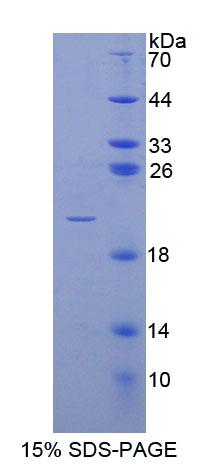 Figure 1. SDS-PAGE