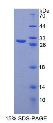 Figure 1. SDS-PAGE