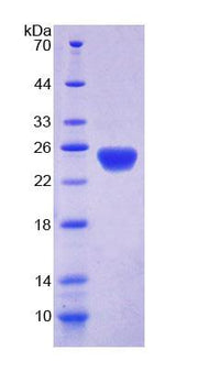 Figure 1. SDS-PAGE