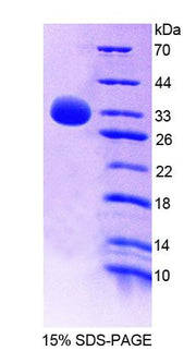 Figure 1. SDS-PAGE