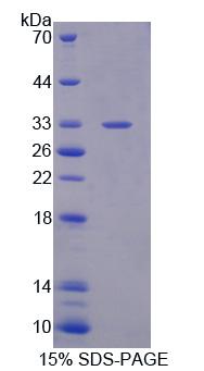 Figure 1. SDS-PAGE