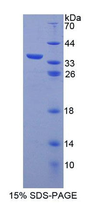 Figure 1. SDS-PAGE