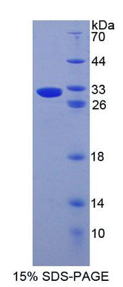 Figure 1. SDS-PAGE