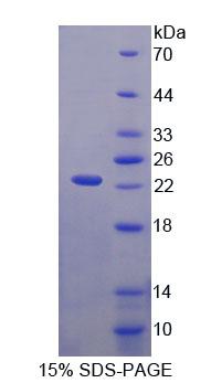 Figure 1. SDS-PAGE