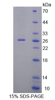Figure 1. SDS-PAGE