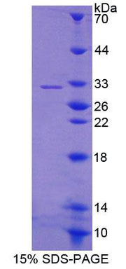 Figure 1. SDS-PAGE