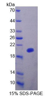 Figure 1. SDS-PAGE
