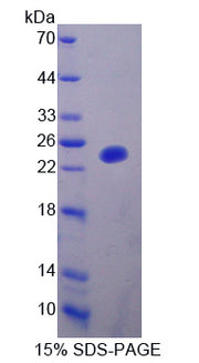 Figure 1. SDS-PAGE