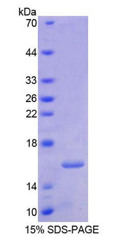 Figure 1. SDS-PAGE