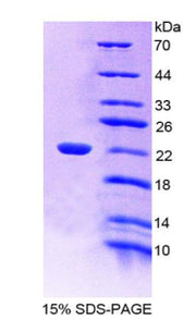 Figure 1. SDS-PAGE