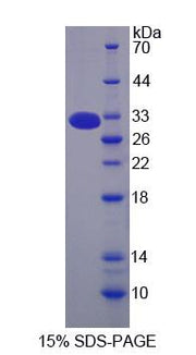 Figure 1. SDS-PAGE
