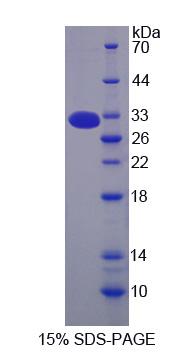 Figure 1. SDS-PAGE
