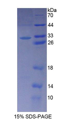 Figure 1. SDS-PAGE