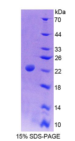 Figure 1. SDS-PAGE