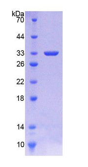 Figure 1. SDS-PAGE
