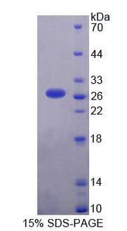 Figure 1. SDS-PAGE