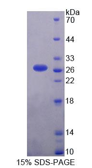 Figure 1. SDS-PAGE