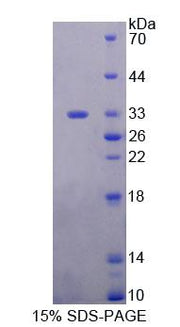 Figure 1. SDS-PAGE