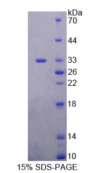 Figure 1. SDS-PAGE
