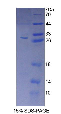 Figure 1. SDS-PAGE