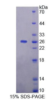 Figure 1. SDS-PAGE