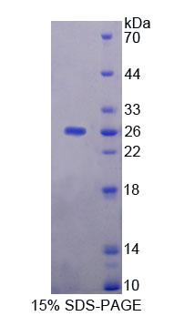 Figure 1. SDS-PAGE