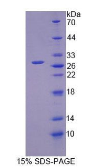 Figure 1. SDS-PAGE