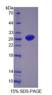 Figure 1. SDS-PAGE