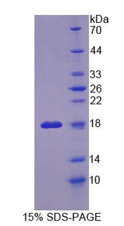 Figure 1. SDS-PAGE