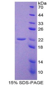Figure 1. SDS-PAGE