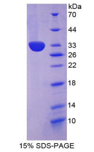 Figure 1. SDS-PAGE