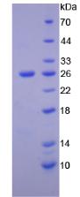 Figure 3. SDS-PAGE