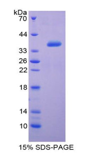 Figure 1. SDS-PAGE