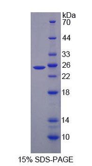 Figure 1. SDS-PAGE