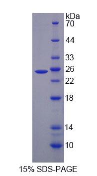 Figure 1. SDS-PAGE