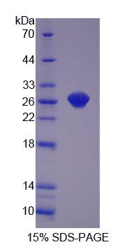 Figure 1. SDS-PAGE