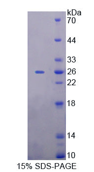 Figure 1. SDS-PAGE