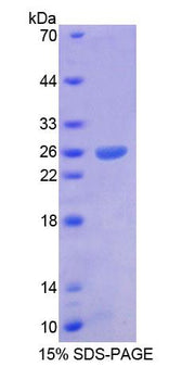 Figure 1. SDS-PAGE