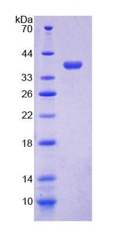 Figure 1. SDS-PAGE