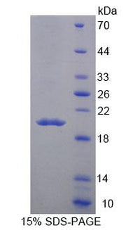 Figure 1. SDS-PAGE