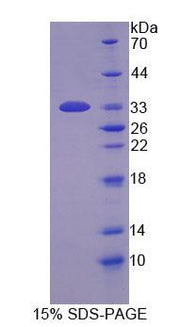 Figure 1. SDS-PAGE