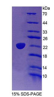 Figure 1. SDS-PAGE
