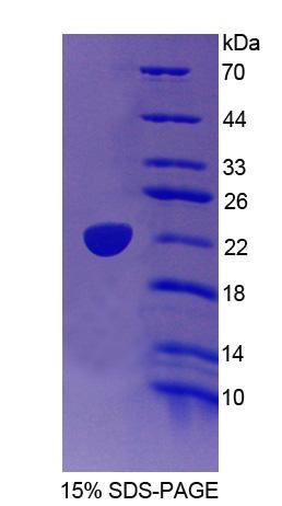 Figure 1. SDS-PAGE