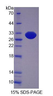 Figure 1. SDS-PAGE