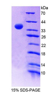 Figure 1. SDS-PAGE