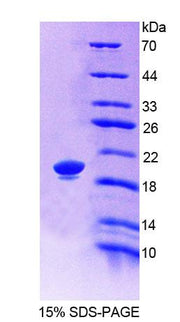 Figure 1. SDS-PAGE