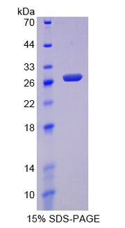 Figure 1. SDS-PAGE
