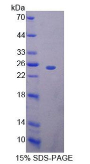 Figure 1. SDS-PAGE