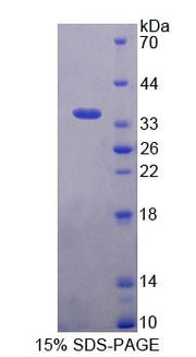 Figure 1. SDS-PAGE