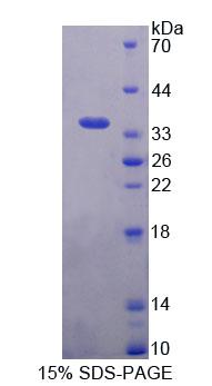 Figure 1. SDS-PAGE